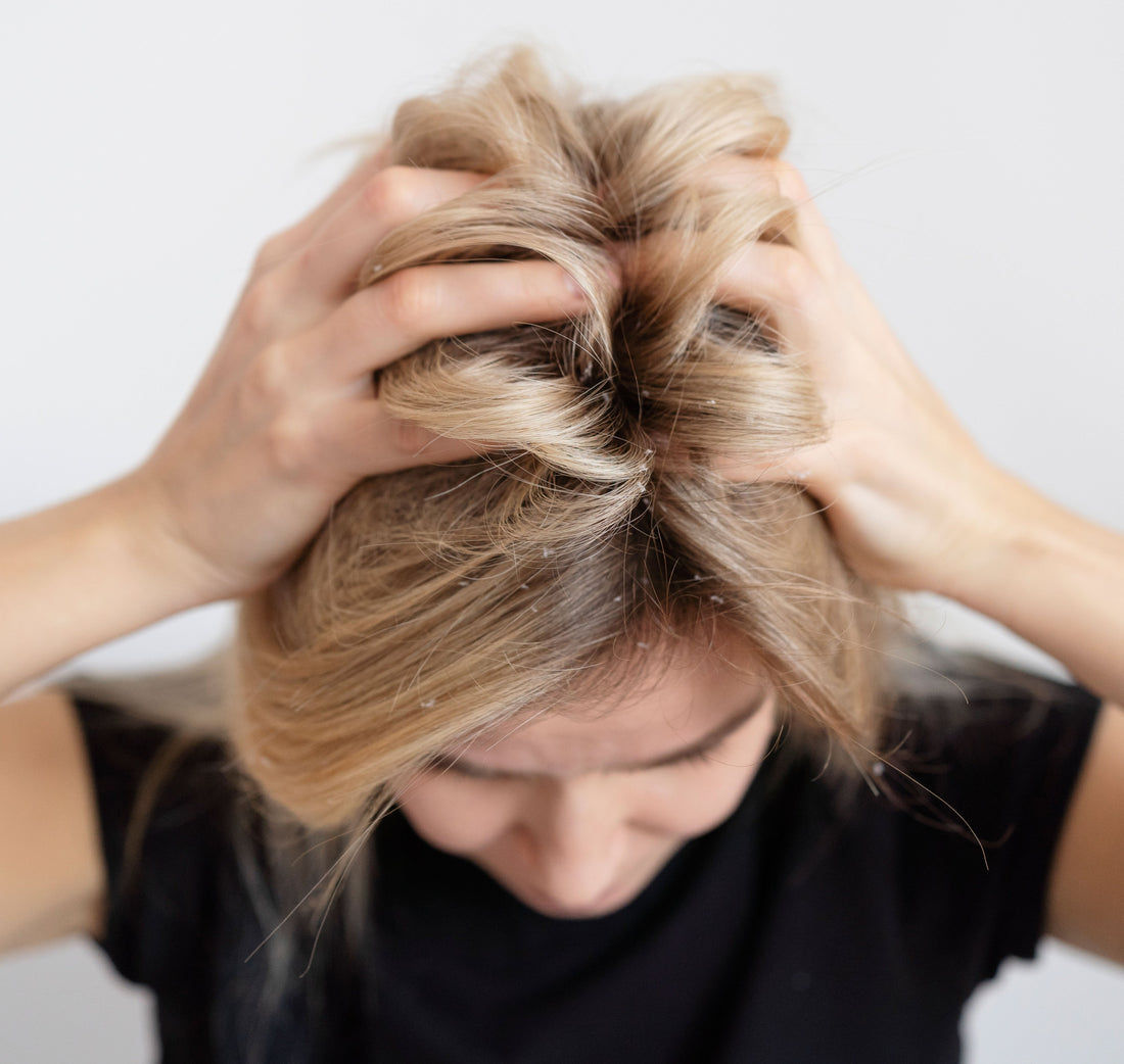 Common Hair problems and its Prevention - Adven