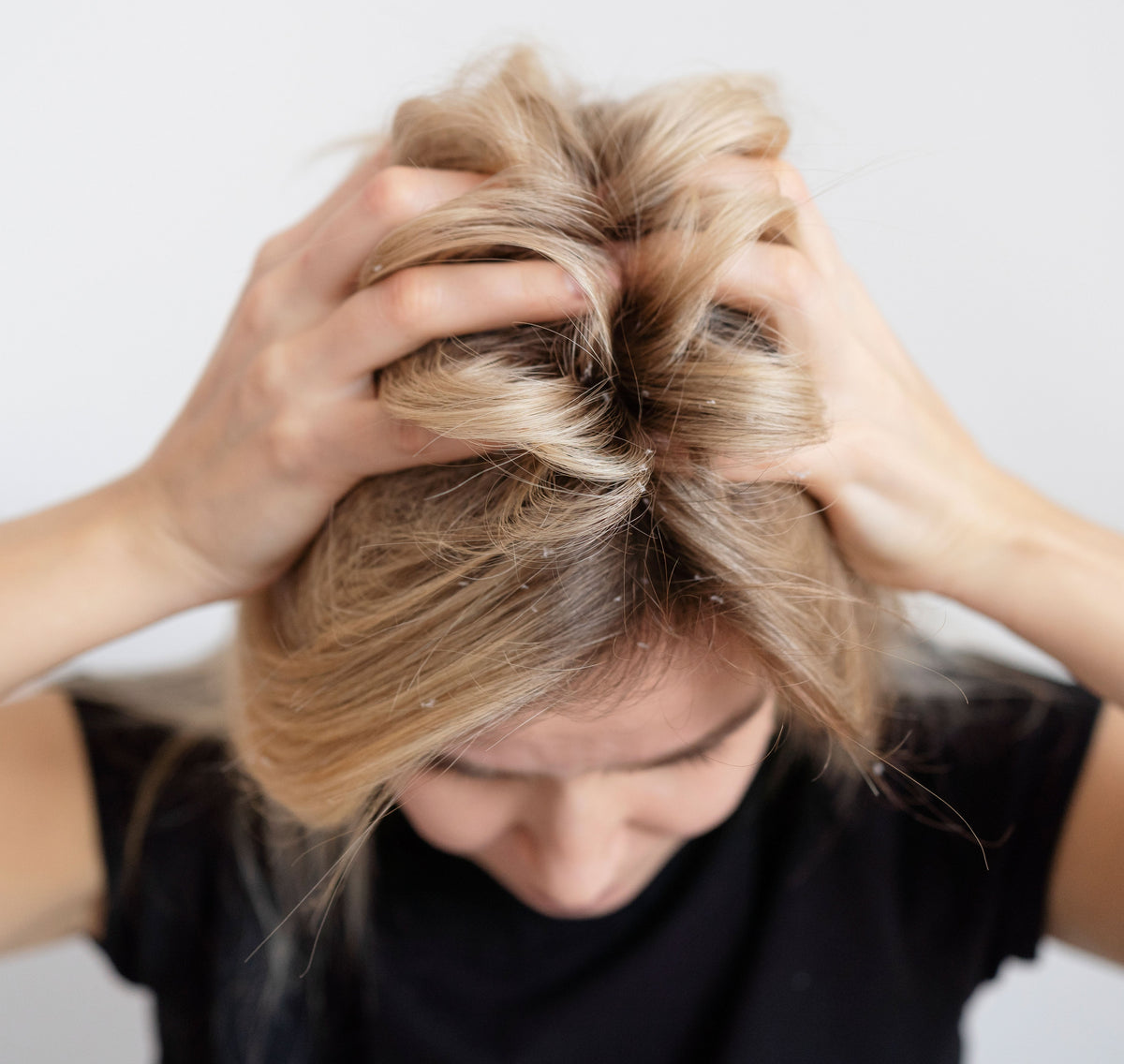 Common Hair problems and its Prevention