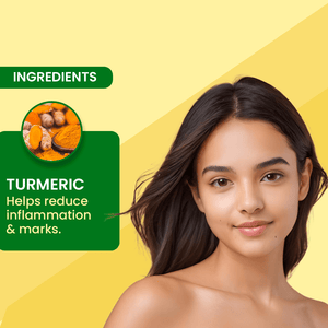 Adven Naturals D - Acne Soap - Adven