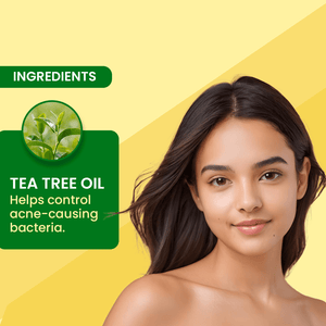 Adven Naturals D - Acne Soap - Adven